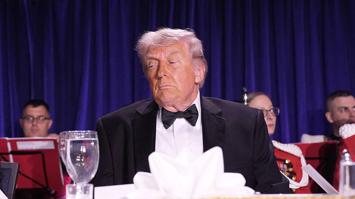 Image of Donald Trump was previously diagnosed with chronic venous insufficiency.