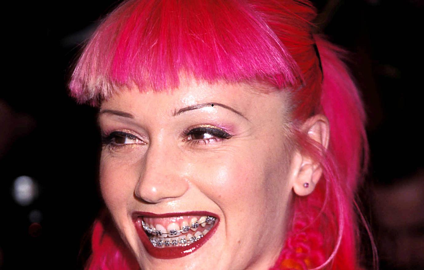 gwen stefani before and after braces