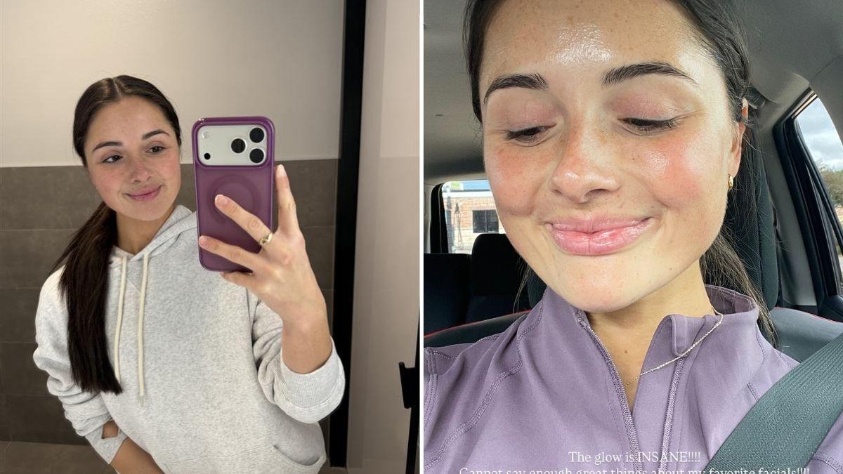 image of The star partnered with Hydrafacial to make her glow! 