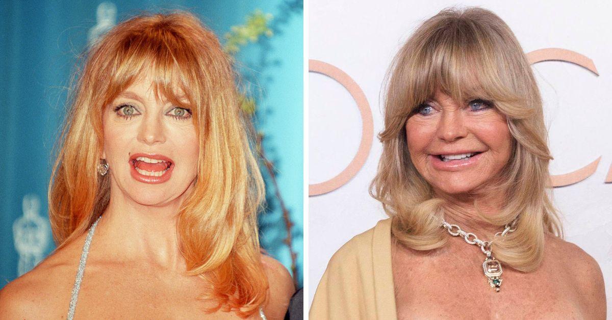 goldie hawn plastic surgery