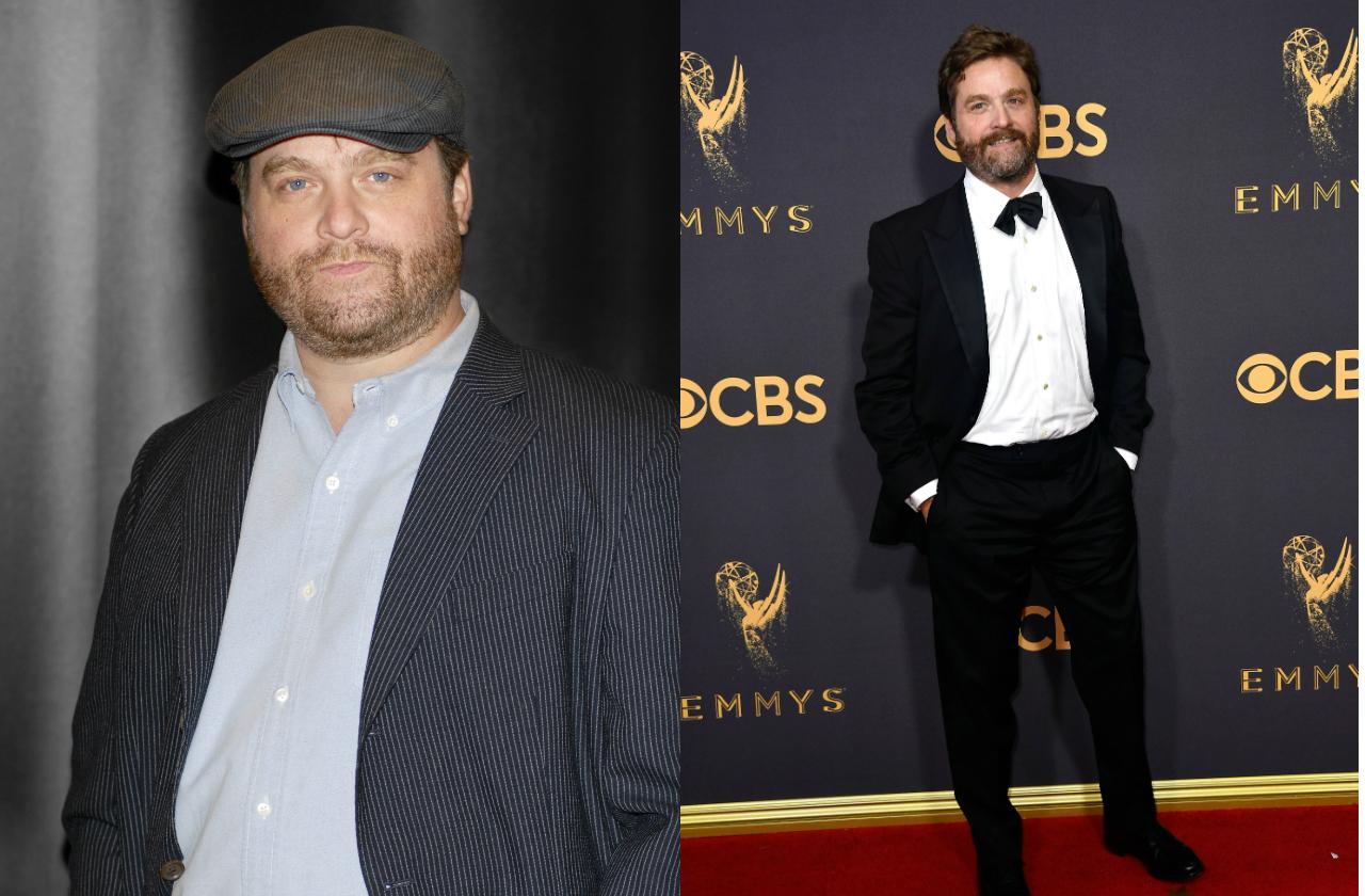 Zach Galifianakis wears a jacket and hat in the before pic and a black tux at the 2017 Emmy Awards in after photo.