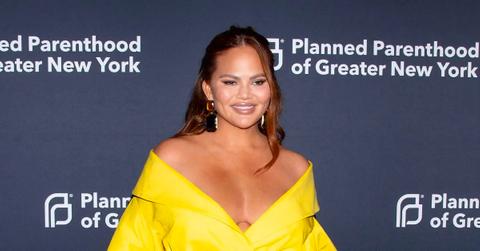 chrissy teigen hater surgeon overfilling face gained weight pp