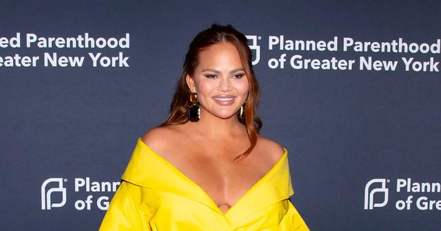 chrissy teigen hater surgeon overfilling face gained weight pp