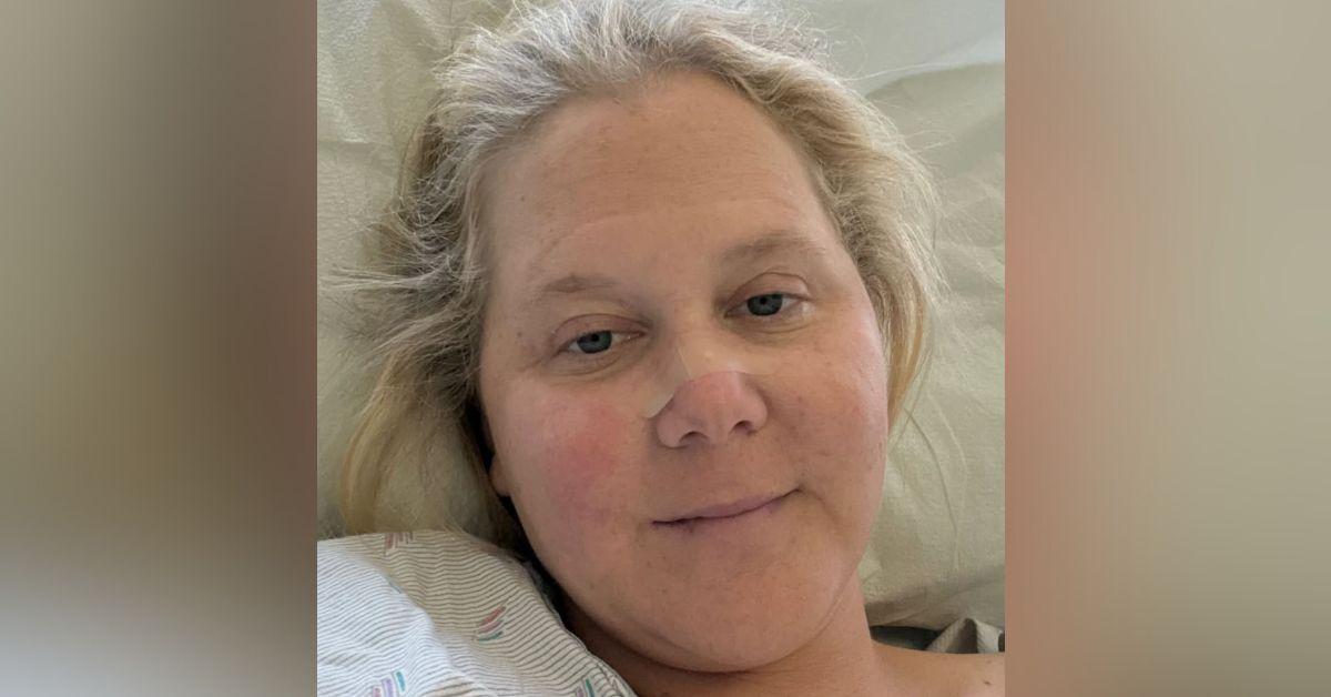 photo of Amy Schumer underwent a hysterectomy to treat endometriosis