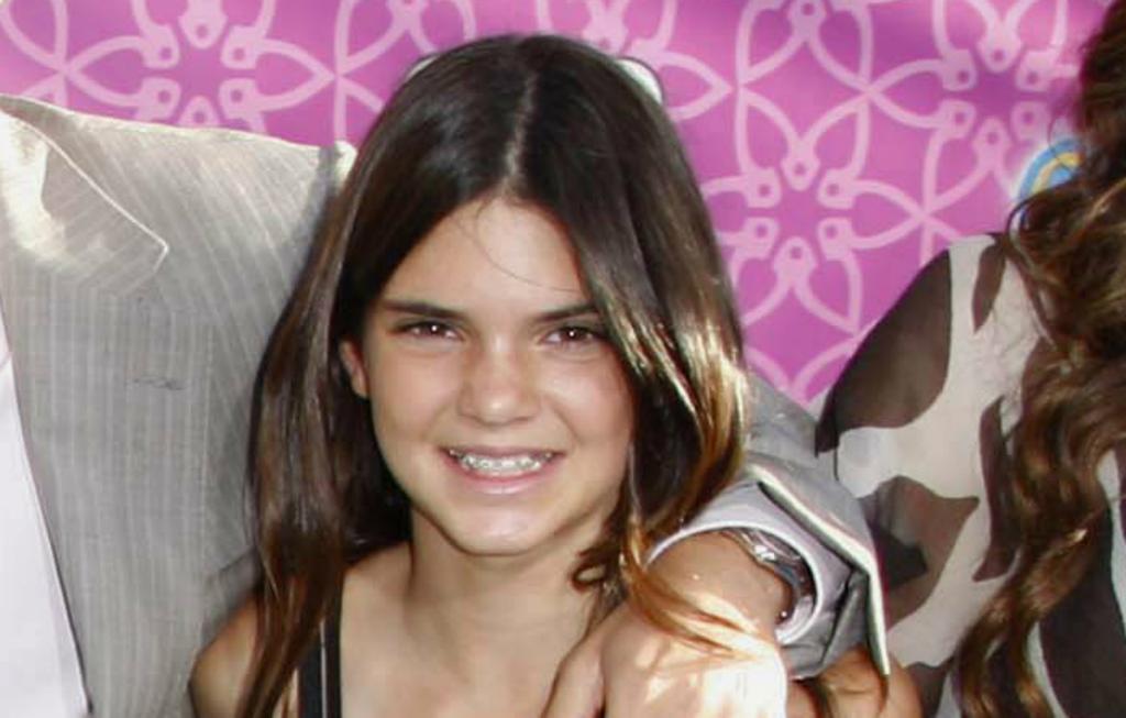 Metal Mouth! Throwback Photos of Celebs Before & After Braces