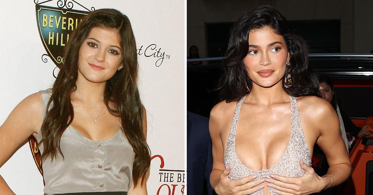 Kylie Jenner Mocked After Denying Plastic Surgery On Face
