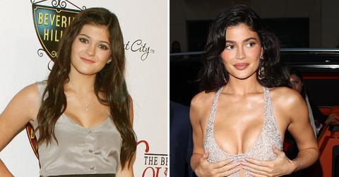 kylie jenner says hasnt touched face pp