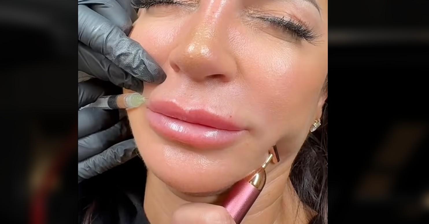 teresa giudice trying more natural look dissolves lip fillers receiving backlash