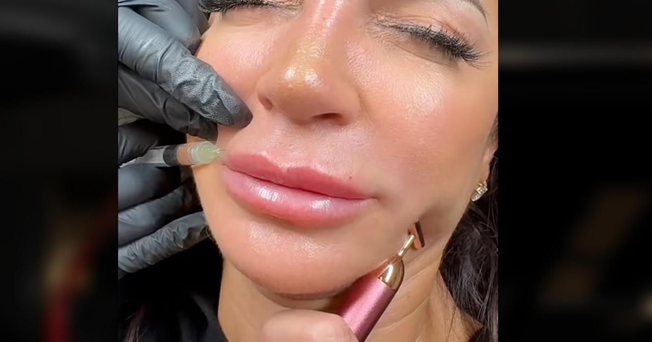 Teresa Giudice Dissolves Lip Fillers For A 'More Natural Look': Photos