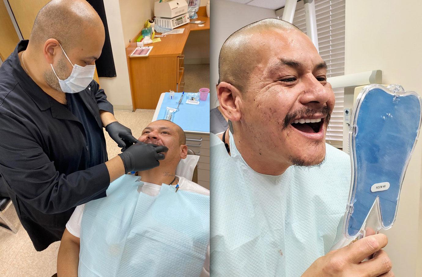 TikTok Star Nathan Adodaca getting teeth fixed