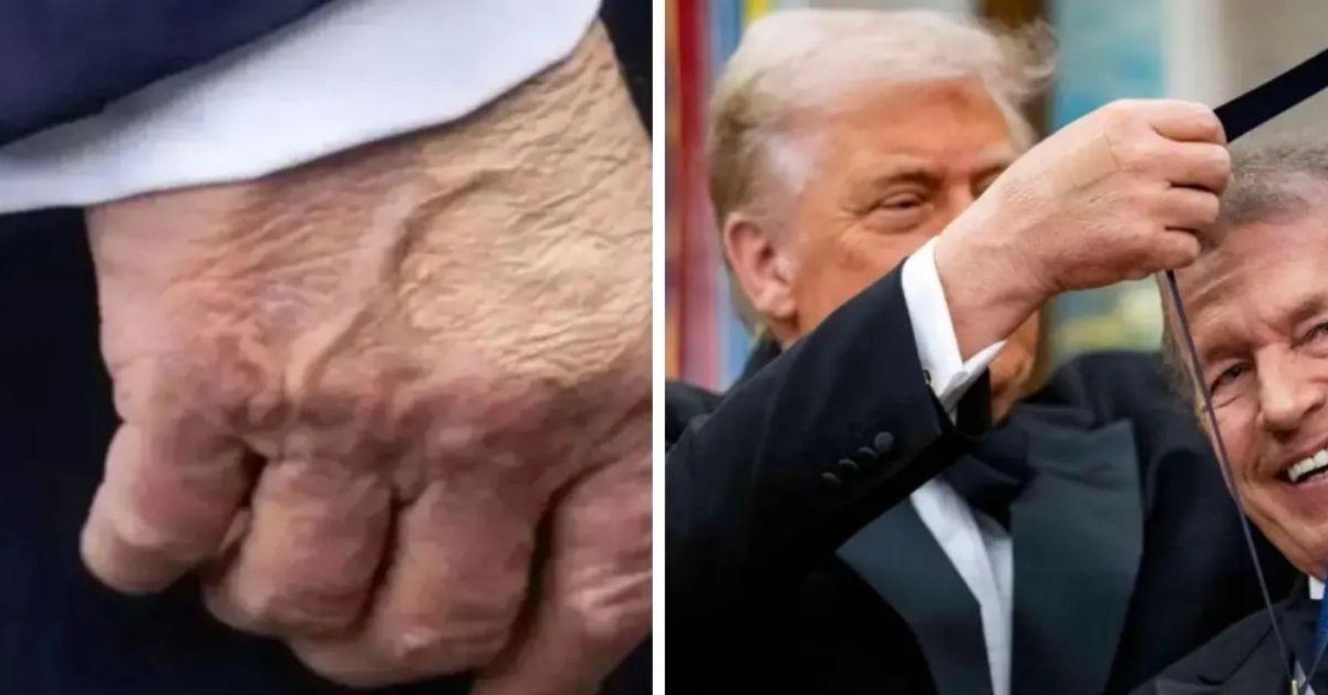 image of Donald Trump previously touched upon why he puts makeup on his hands. 