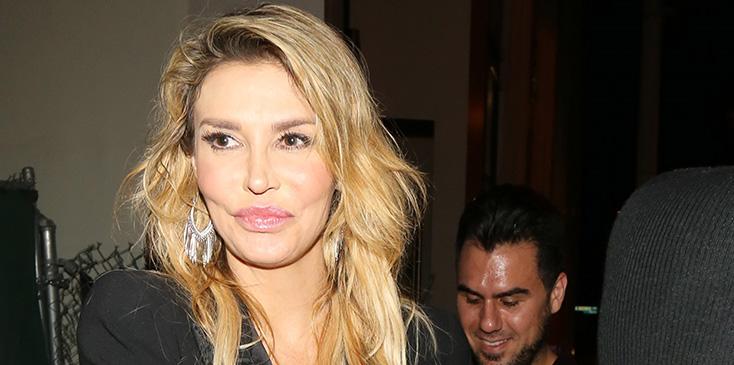 Brandi glanville paralyzed upper lip laser hair removal