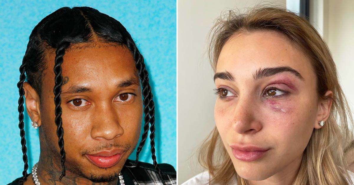 tyga turns himself in lapd alleged domestic assault ex girlfriend camarayn swanson ok