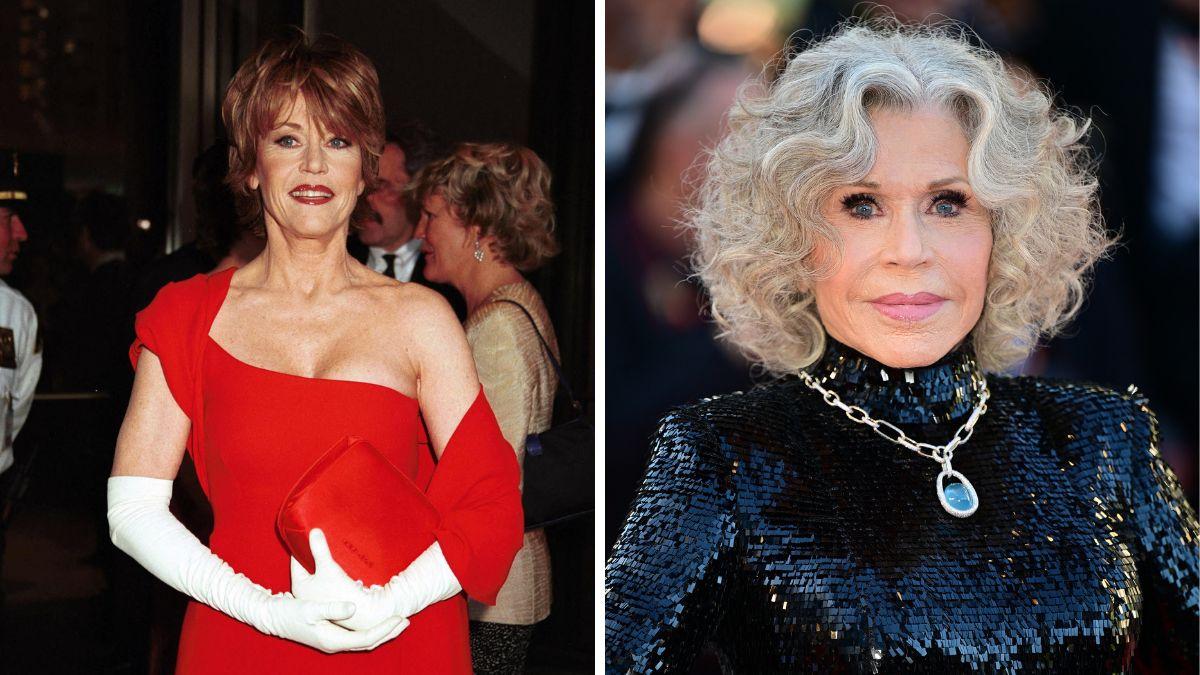celebrities who got facelifts before after photos