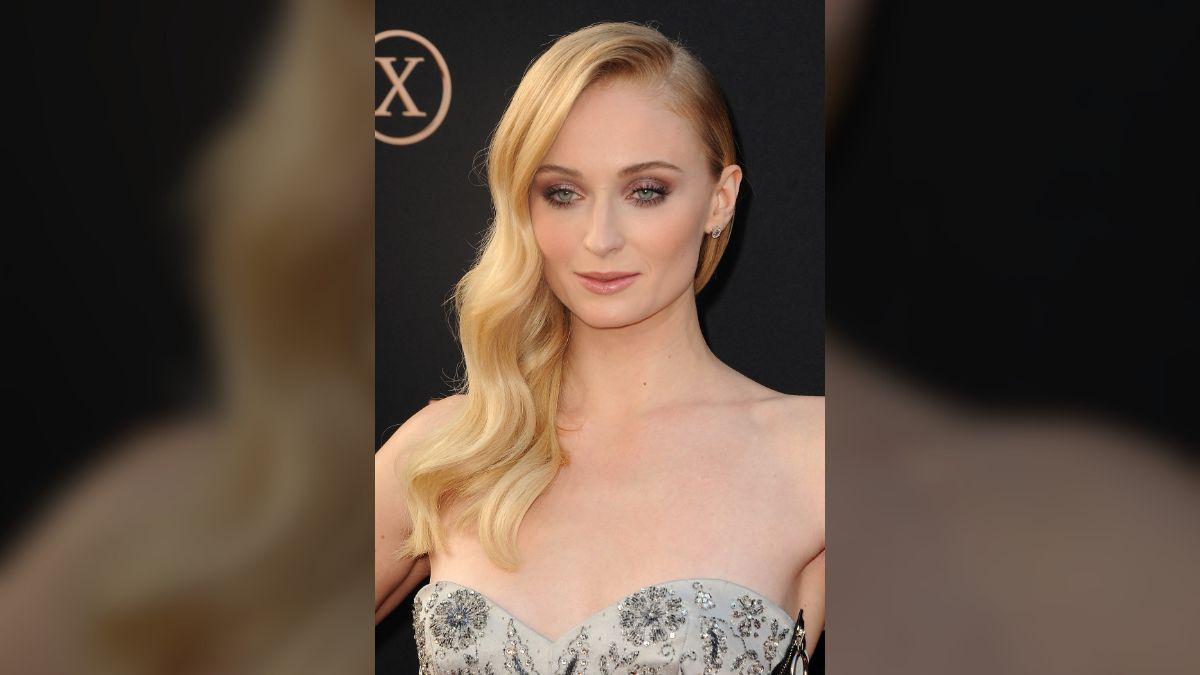 image of The actress' preparation revealed a chronic back problem.