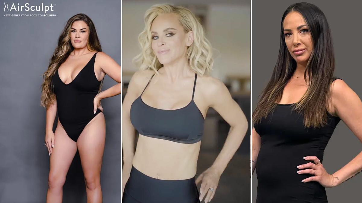 airsculpt celebrities pp