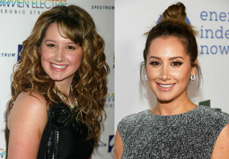 Ashley tisdale celebrity plastic surgery