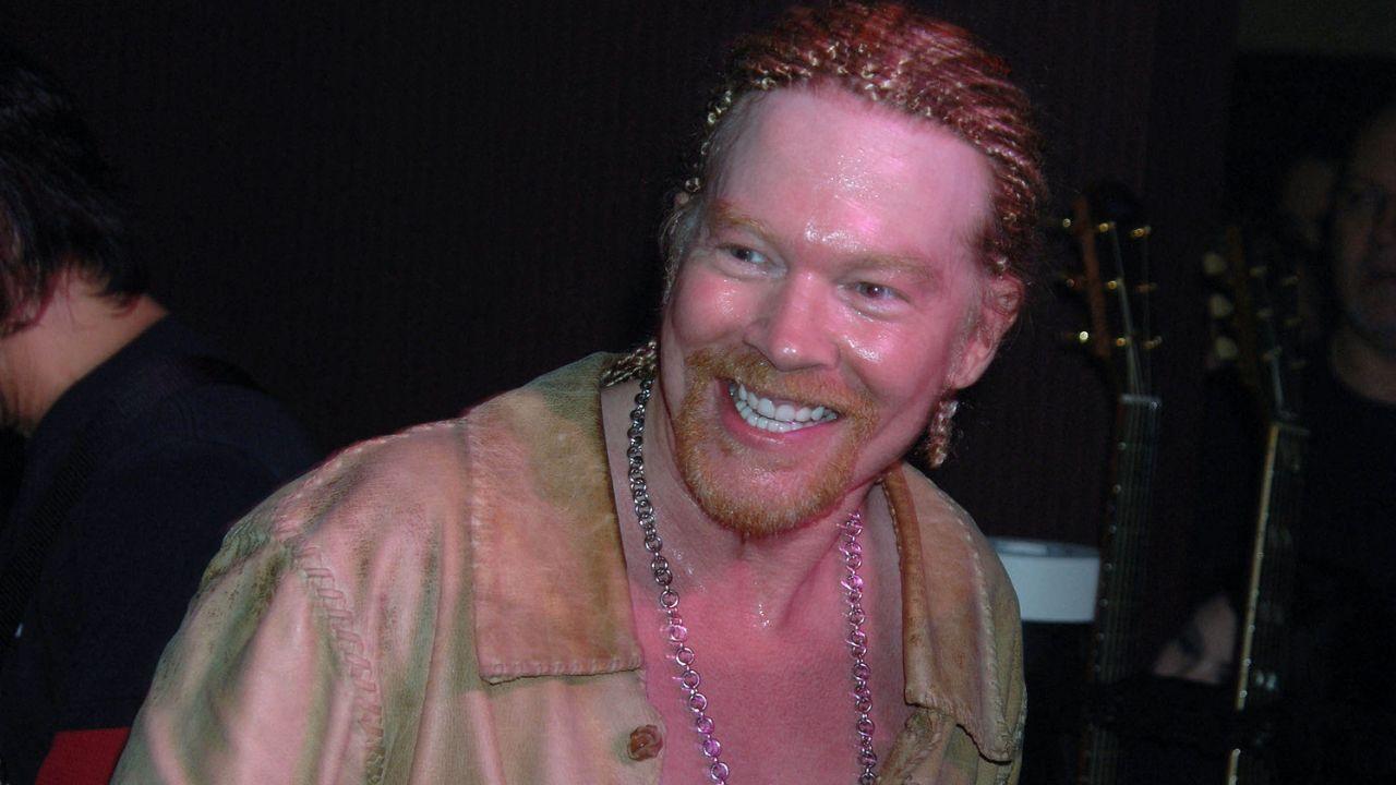 Image of Axl Rose got 'really crazy' TMJ while delivering a 3-hour Guns N' Roses show.