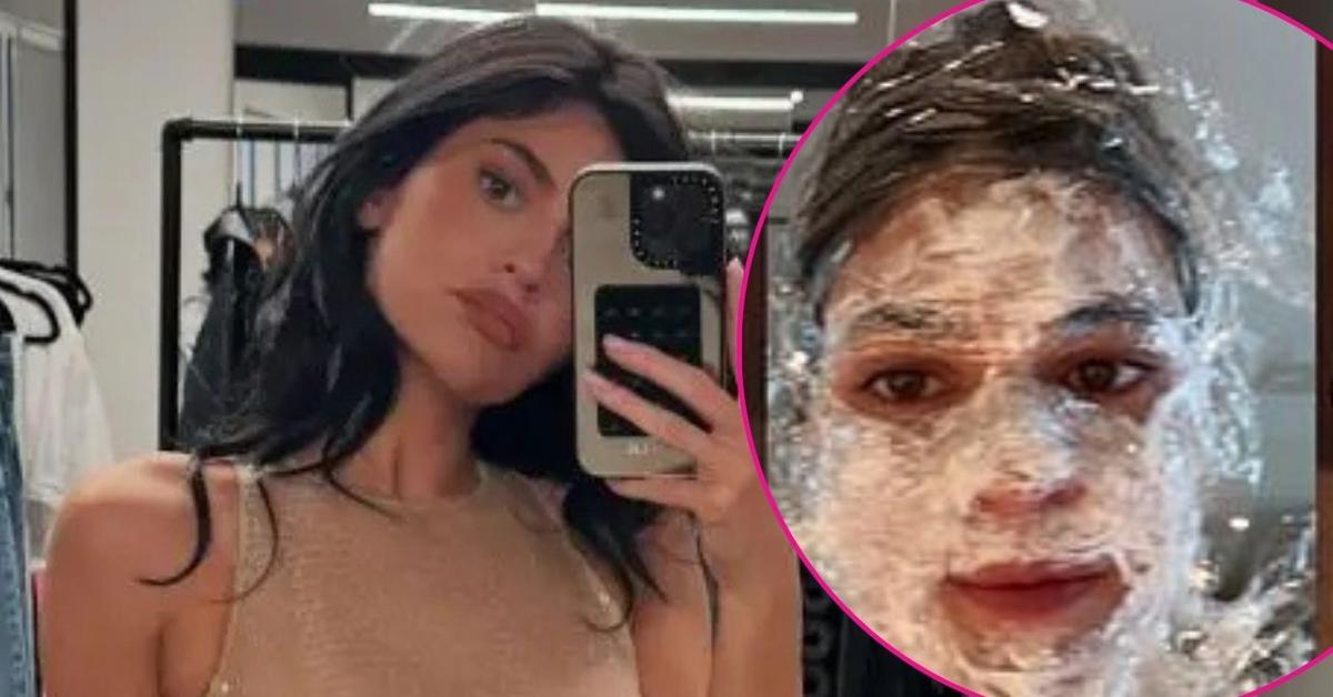 Kylie Jenner Looks Unrecognizable as She Shares Unflattering Photo of Her Face Covered in Numbing Cream After Microneedling Session