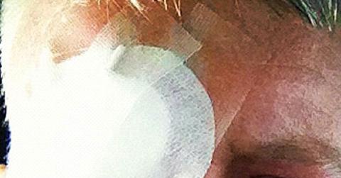 Anderson Cooper Eye Patch