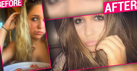 Arielle biermann before after wide