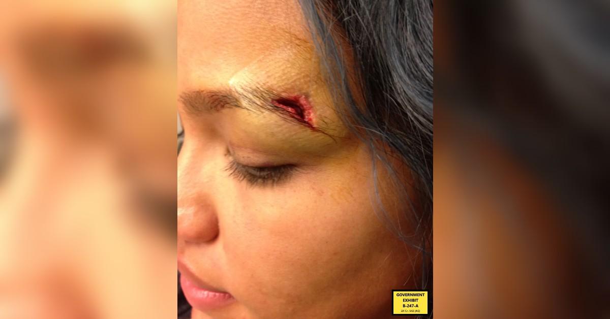 cassie ventura eyebrow gash bedframe southern distric new york