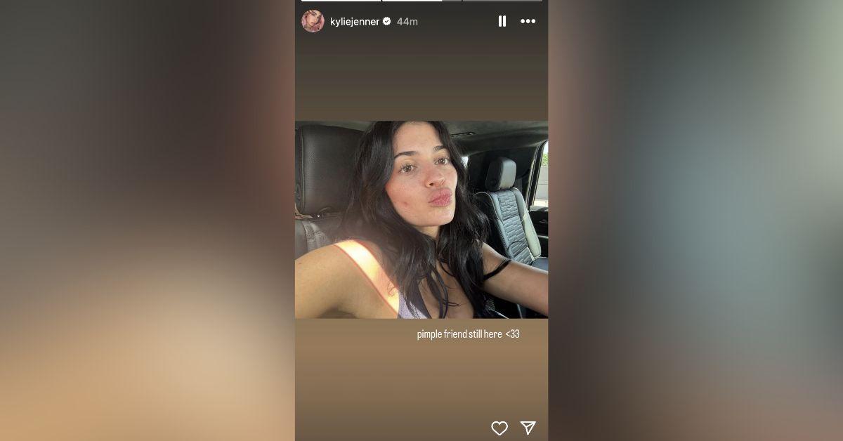 kylie jenner makeup free selfie pimple face