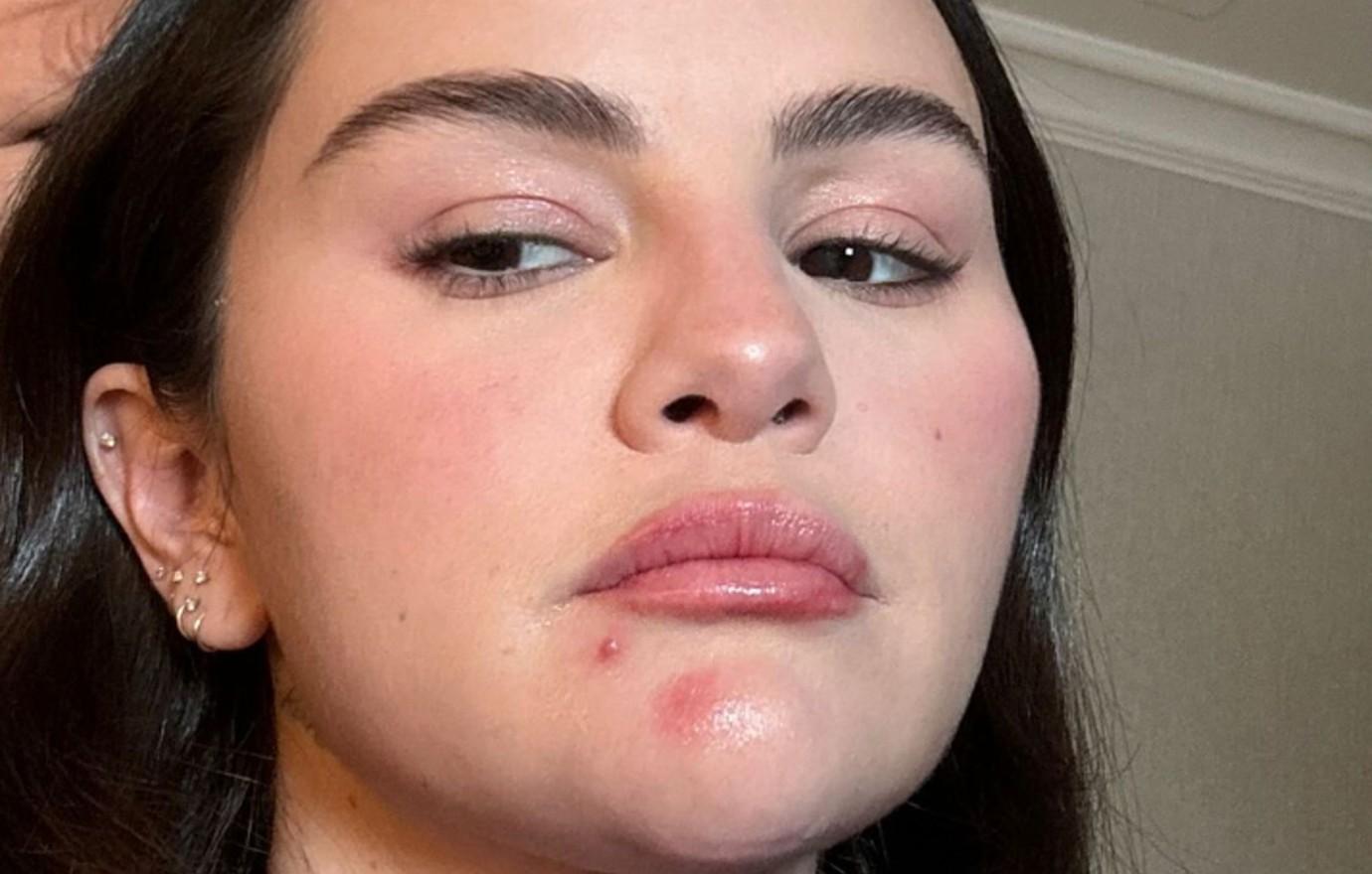 selena gomez exposes acne new selfie even skin over me