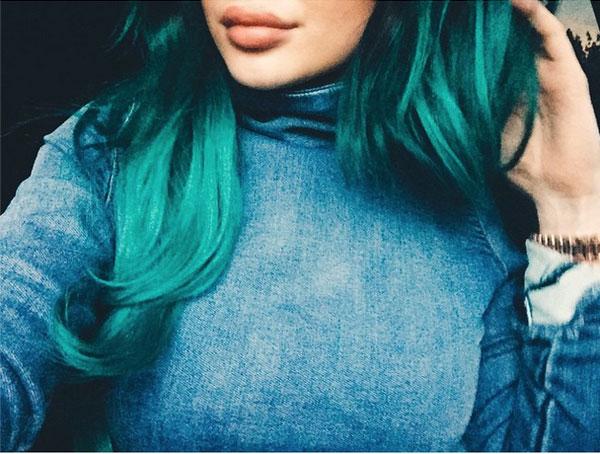 Kylie jenner big lips 01