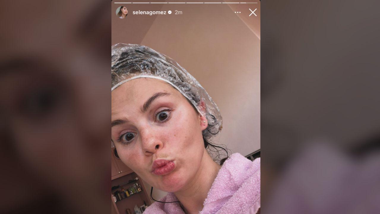 image of Selena Gomez posted a makeup-free selfie.
