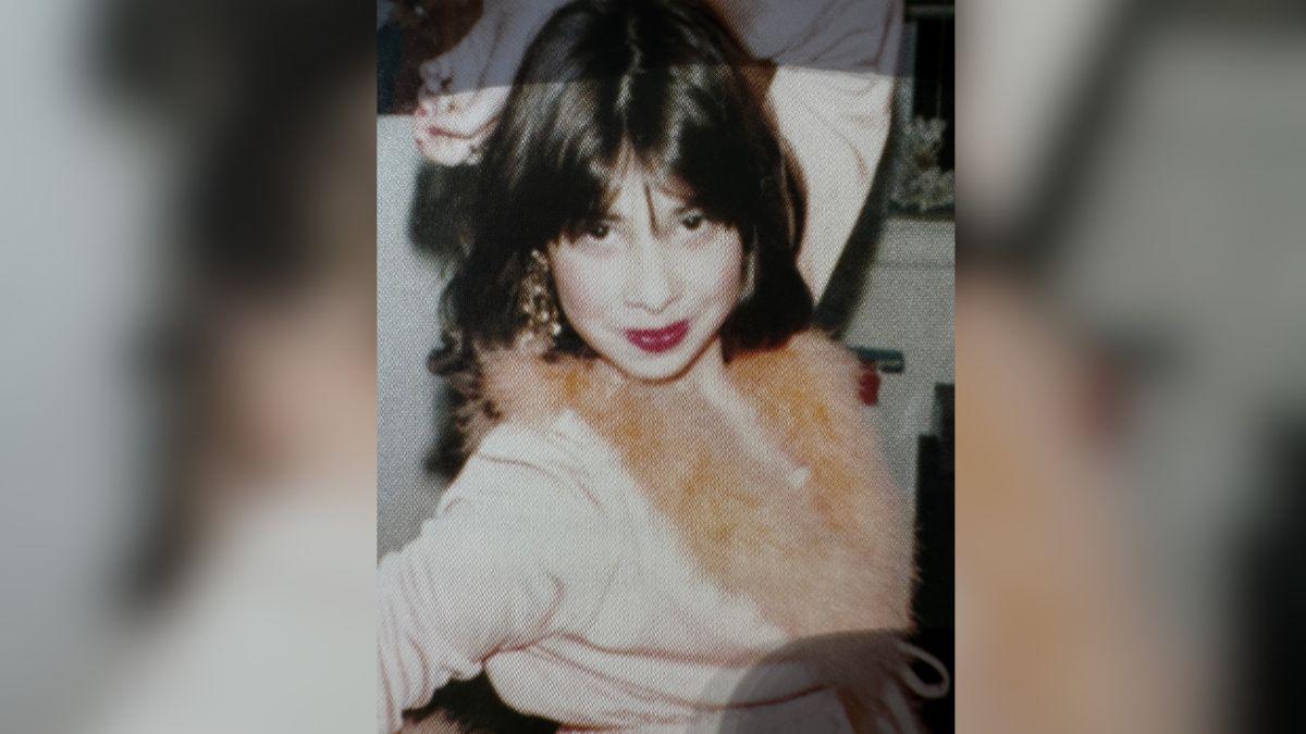 image of The star is now speaking about her psoriasis.