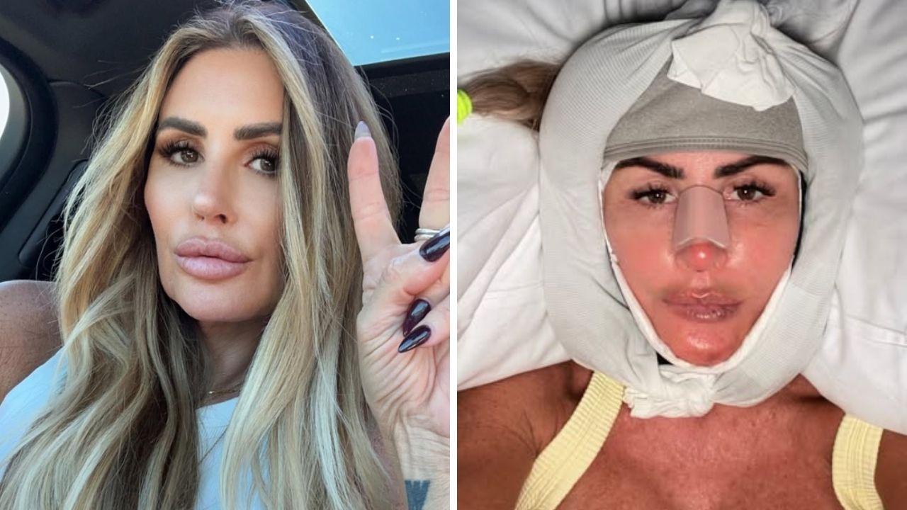 rachel uchitel dramatic facelift transformation before after photos