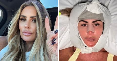 rachel uchitel dramatic facelift transformation before after photos
