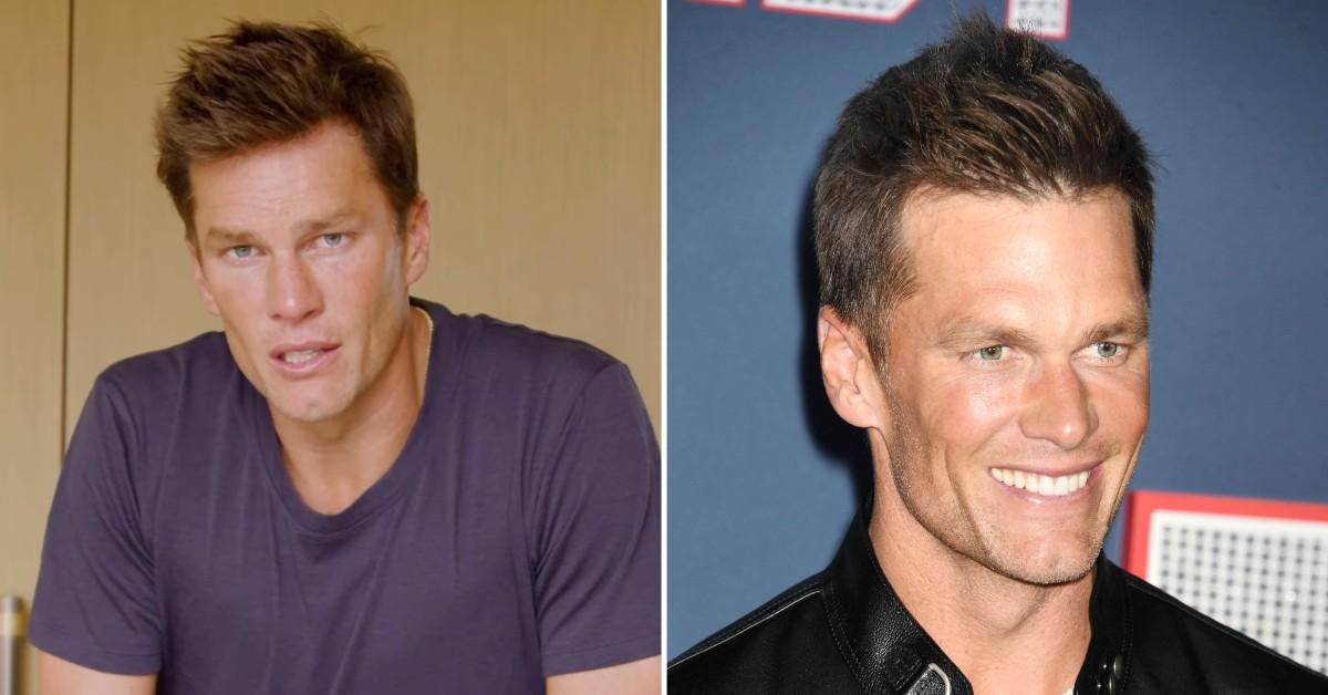 Did Tom Brady Have Plastic Surgery? Fans Troll His New Look — Photos