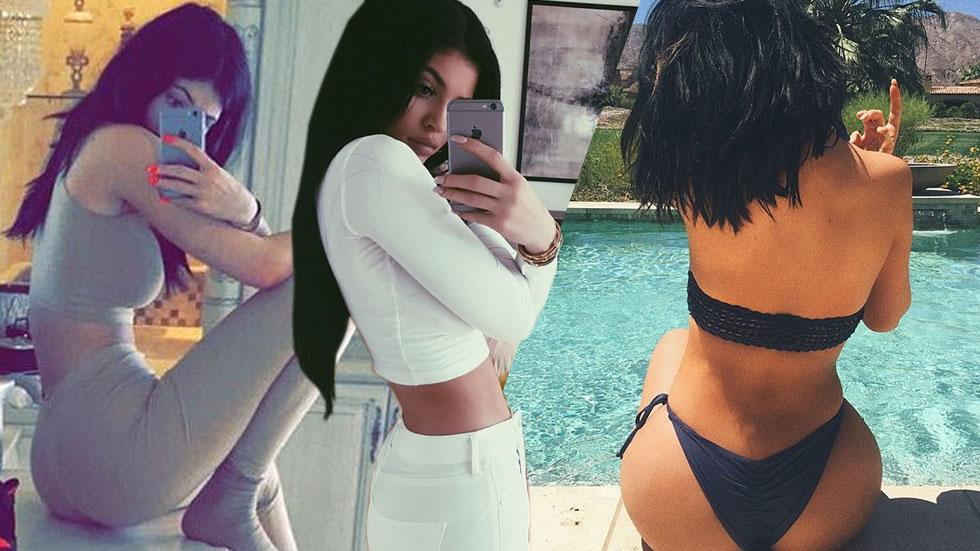 Kylie jenner butt injections plastic surgery