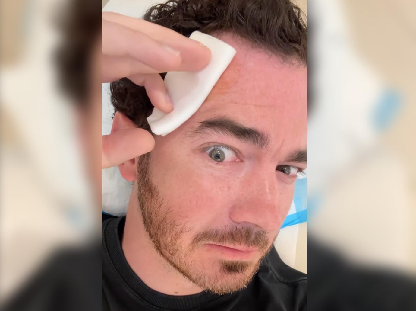 kevin jonas skin cancer surgery basal cell carcinoma head removed