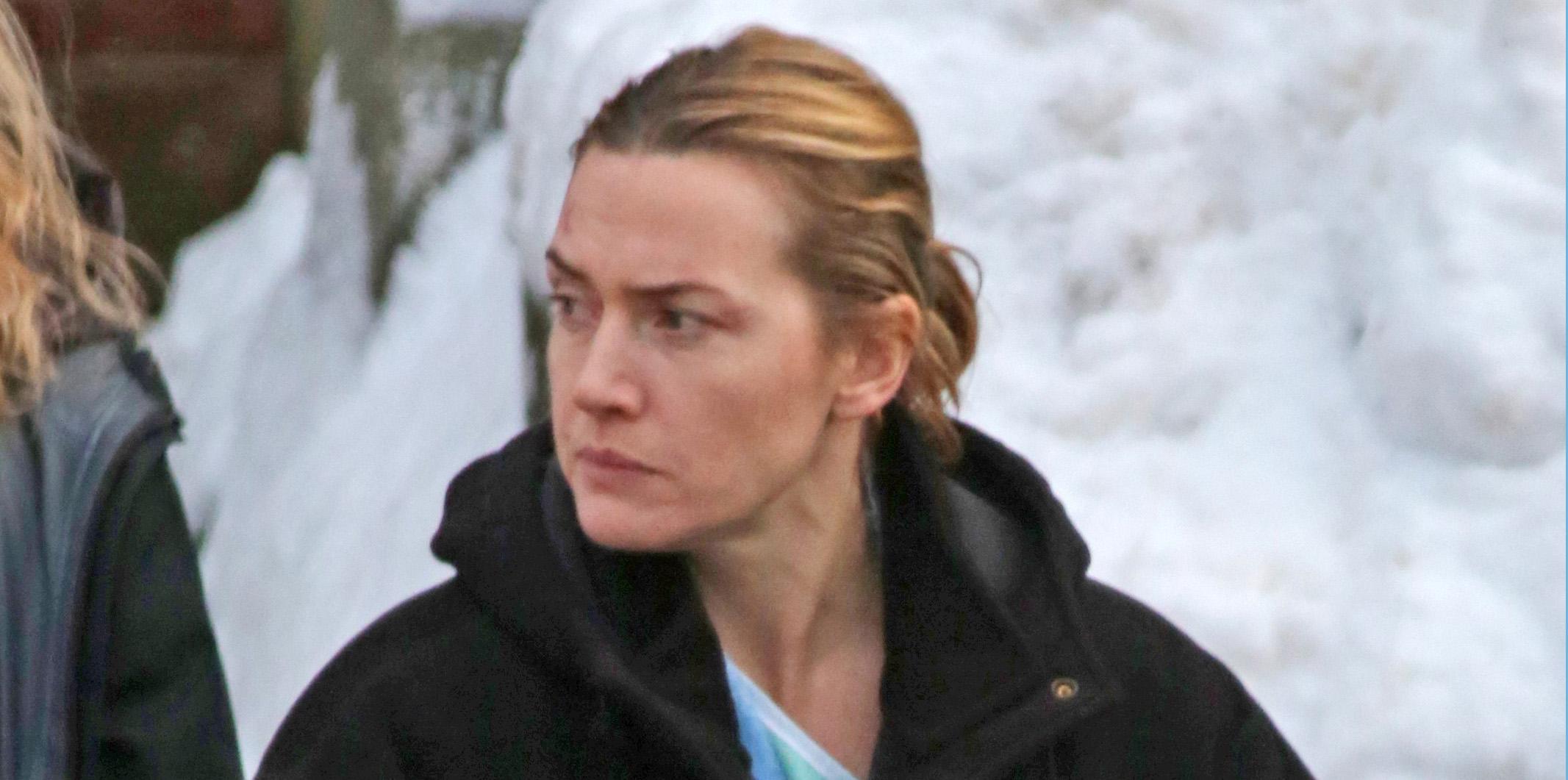 *EXCLUSIVE* A bruised Kate Winslet finishes scenes at the hospital