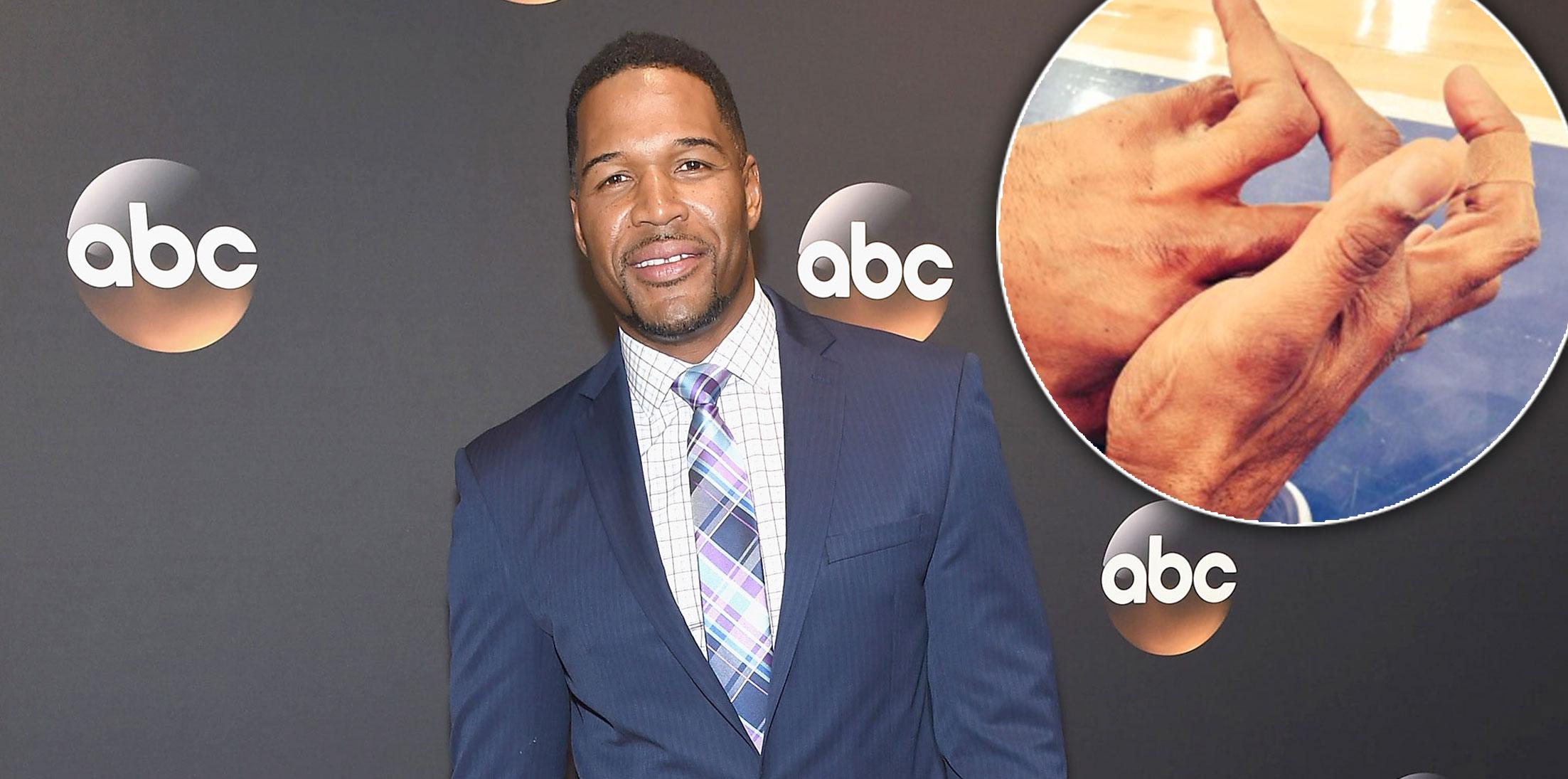 How Did Michael Strahan Lose Part Of His Pinky Finger 