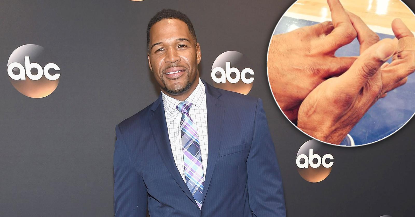 How Did Michael Strahan Lose Part Of His Pinky Finger 
