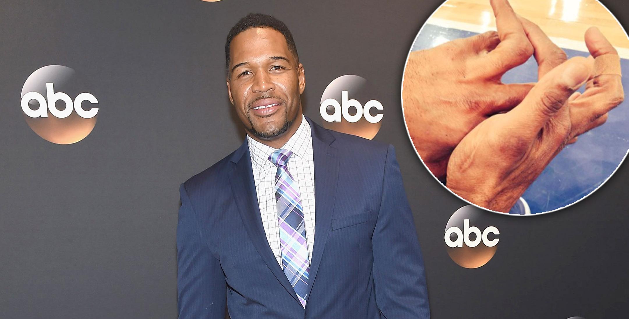 How Did Michael Strahan Lose Part Of His Pinky Finger 