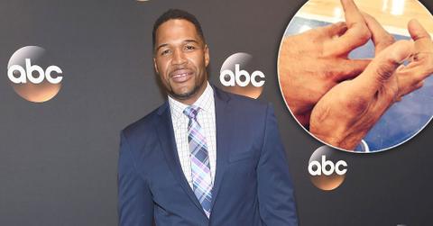 How did michael strahan lose part of pinky