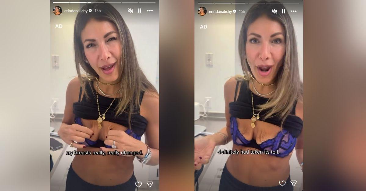 image of The reality star initially considered a simple lift but ultimately chose implants after consulting with her surgeon.