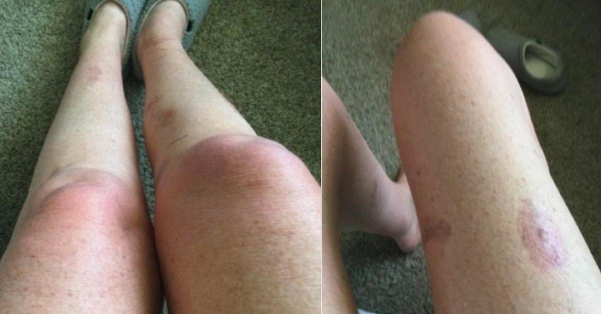 meghan markle threatened lawsuit fan burns bath salts photos