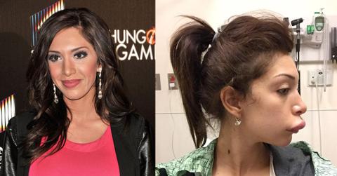 1 farrah abraham plastic surgery SPL