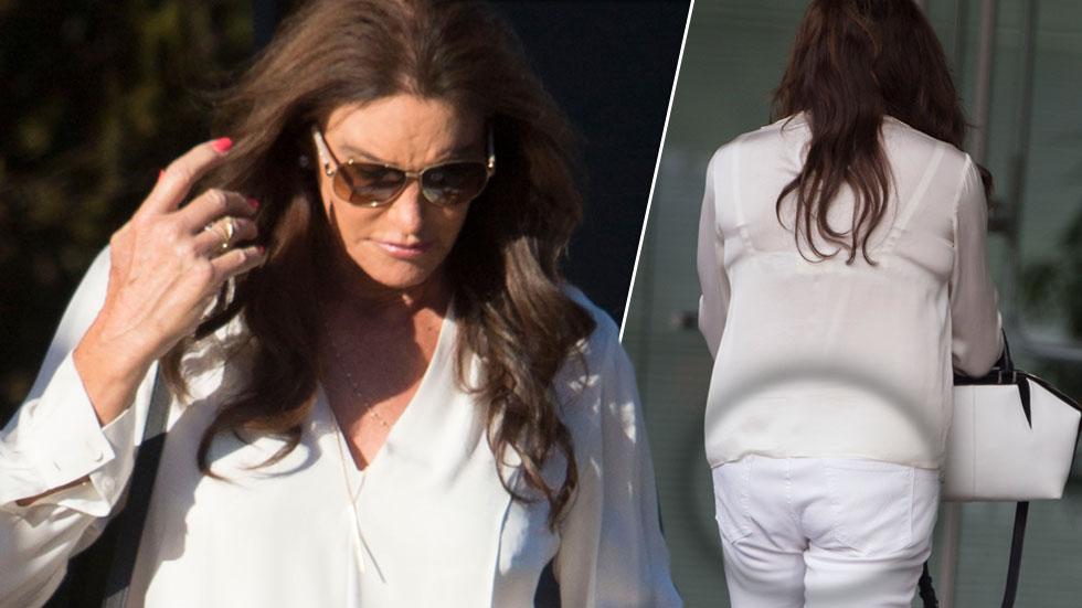 caitlyn jenner butt lift