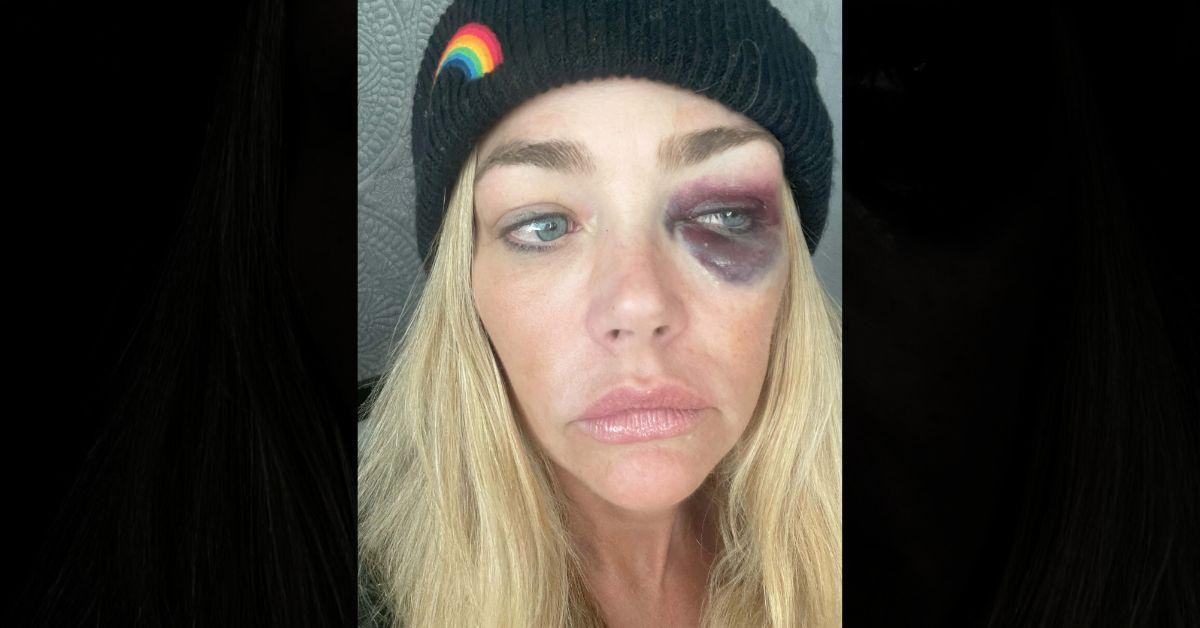 Photo of Denise Richards