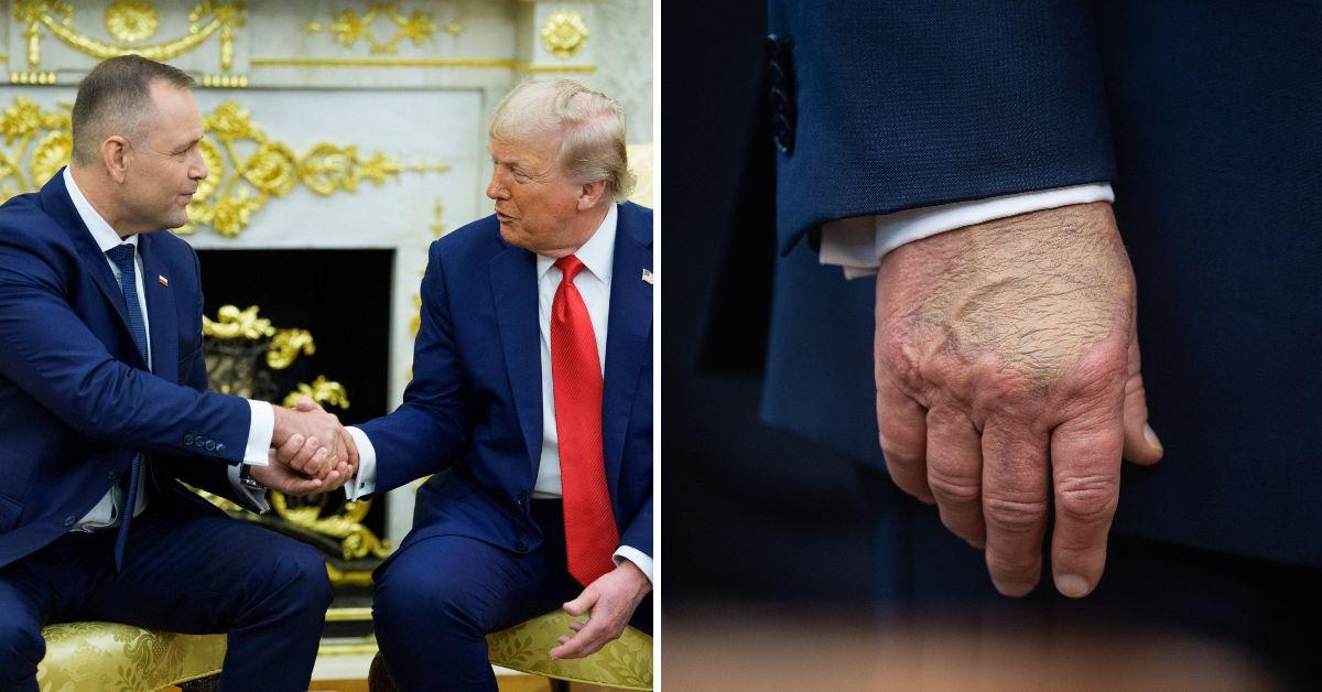 image of Donald Trump claimed he is in 'tremendous health' after getting an MRI he said was 'perfect.'