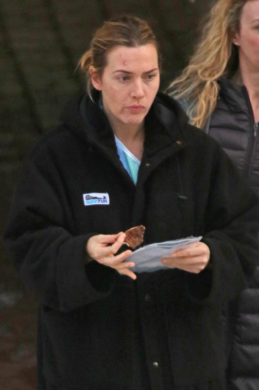 *EXCLUSIVE* A bruised Kate Winslet finishes scenes at the hospital