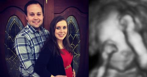 Josh duggar anna pregnant expecting rehab 01