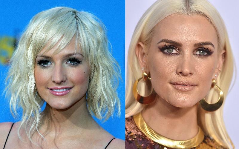 Ashlee simpson celebrity plastic surgery